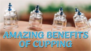 AMAZING Benefits of Cupping Therapy