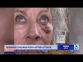 Woman traumatized after brutal attack