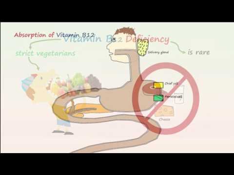 Megaloblastic Anemia Part 1- Vitamin B12 Deficiency Anemia