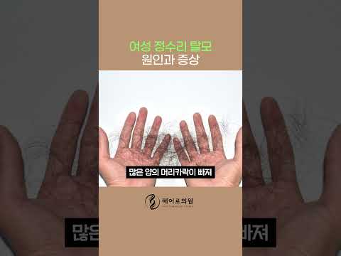 여성 정수리 탈모 원인과 증상 유전적? 다이어트? 출산?