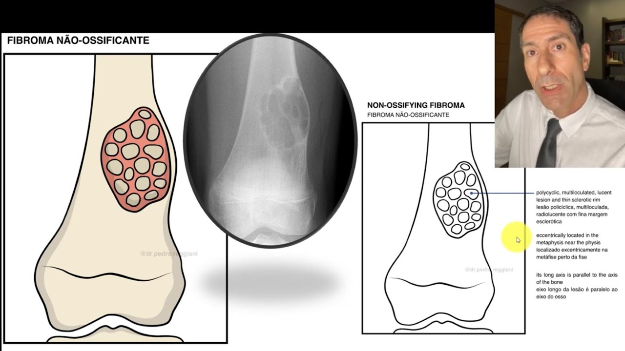 Pedro Reggiani Anzuatégui-14