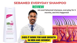 Sebamed Everyday Shampoo Review - We Tried it for 5 Months, and this happened