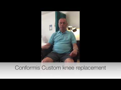 Conforms iTotal Custom Knee Replacement Review