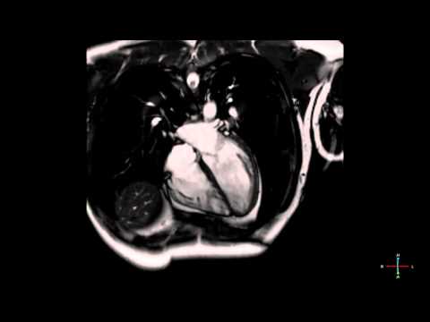 Se fa male nella parte inferiore destra della schiena Tutti la gelatina per le articolazioni, medicina tradizionale