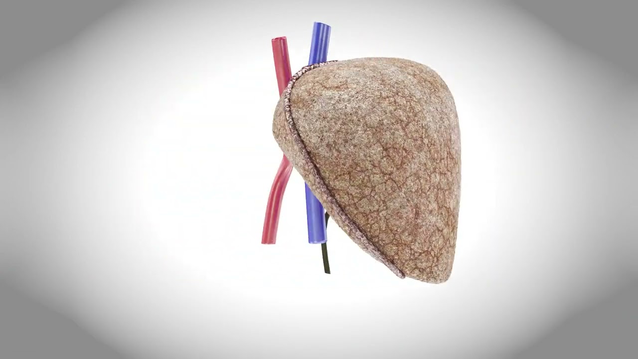 Liver Diseases Collection 3D Model