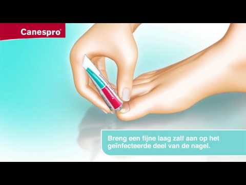 Canespro Behandeling Voor Schimmelnagels - TV Reclame