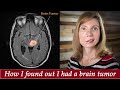 Brain Tumor Journey pt 1: From dizzy spells, headaches, vertigo, to diagnosis, Jodi Orgill Brown