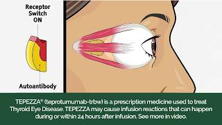 How TEPEZZA Works to Treat Thyroid Eye Disease (TED)