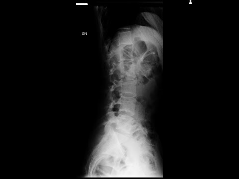 yolomilk - tikai Jums (lost tapes)