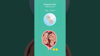 Formation of Twins 💖 #twins #share