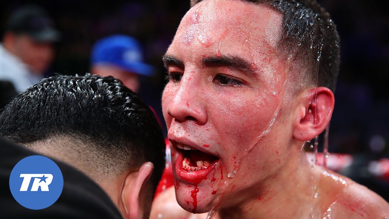 Oscar Valdez vs Scott Quigg | ON THIS DAY FREE FIGHT | Valdez Breaks Jaw, Recovers and Wins