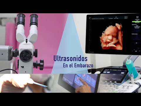 Ultrasonidos En El Embarazo