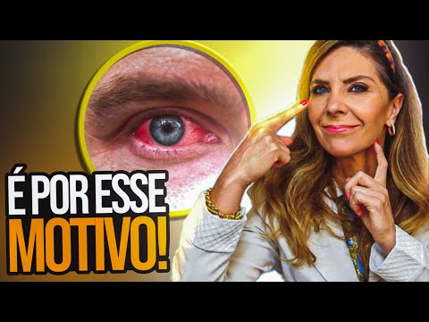 Veias Vermelhas Nos Olhos - Causas De Veias Vermelhas Nos Olhos
