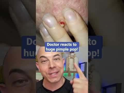 Doctor reacts to huge pimple pop!💥