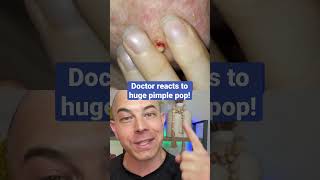 Doctor reacts to huge pimple pop!💥