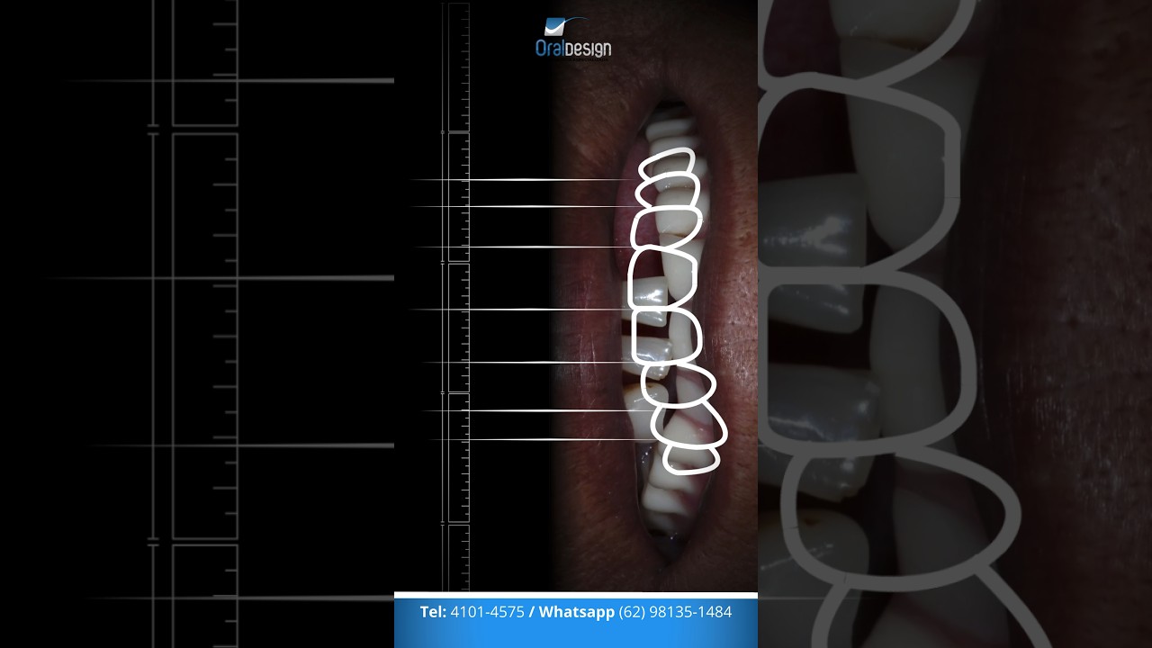 Danilo Monteiro Rezende Pereira-31