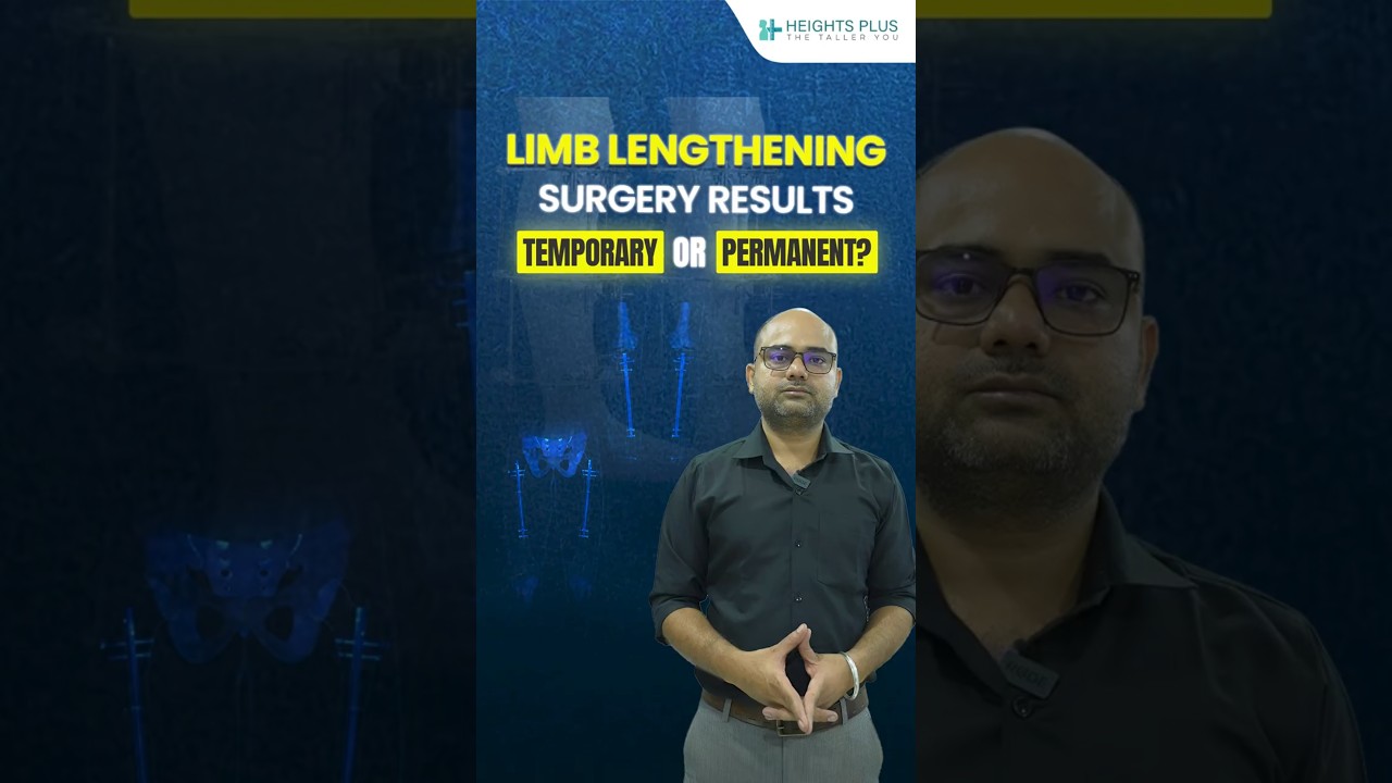 Limb Lengthening Surgery के Results Permanent होते हैं या Temporary? | Heights Plus
