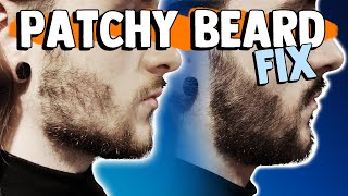 HOW TO FIX A PATCHY BEARD | 6 Methods to fix your patchy beard!