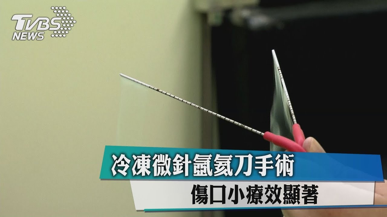 冷凍微針氬氦刀手術 傷口小療效顯著