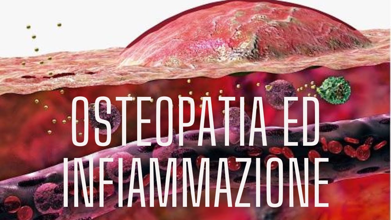 Alessandro Garlinzoni-13