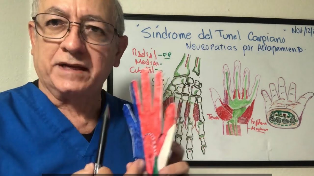 Tunel Carpiano. Neuropatias por atrapamiento. Lesión del nervio mediano