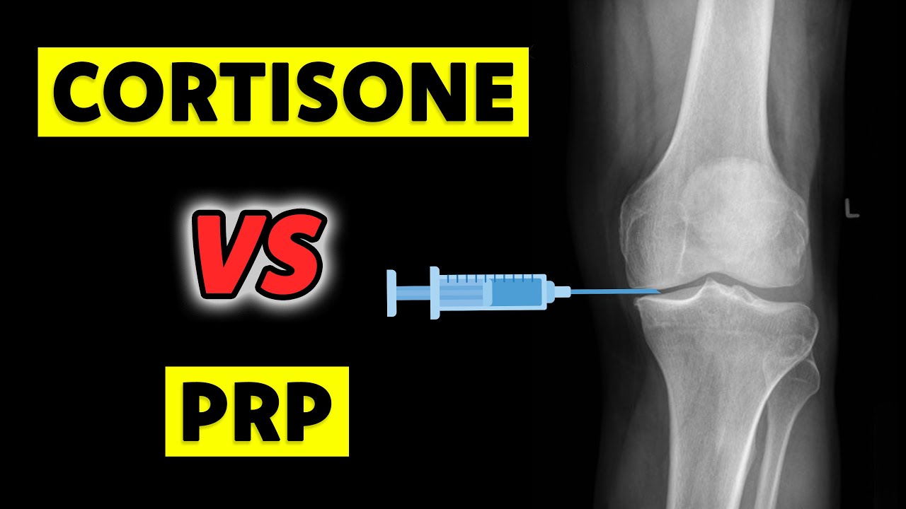 PRP vs Cortisone Shots: A Doctor Breaks Down the BEST Option for You!
