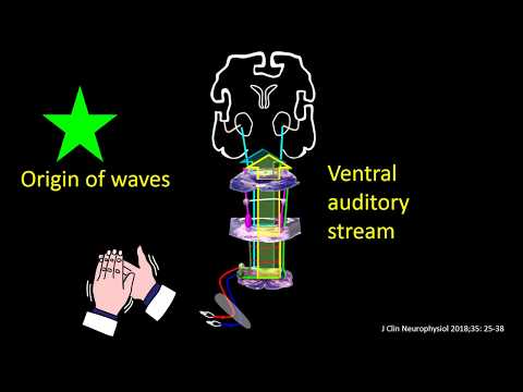 Brainstem auditory evoked potential