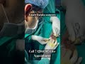 Laser Fistula Surgery I लेजर फिस्टुला ऑपरेशन I Fistula In Ano