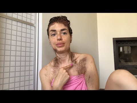 Почему на лице появляются веснушки и как от них избавиться Отбеливающий крем лица spf