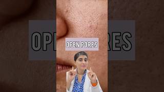 Open Pores | How to get rid of pores on face | Large pores treatment #shorts