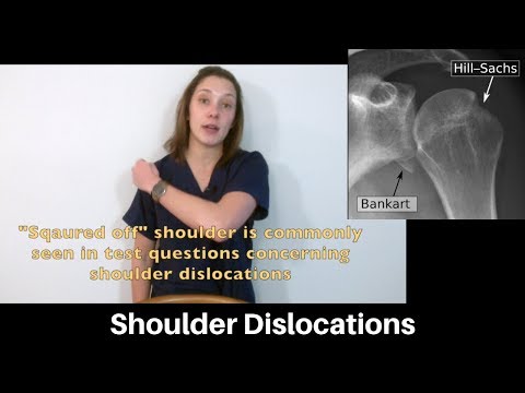 Shoulder dislocation: presentation, physical exam, and imaging