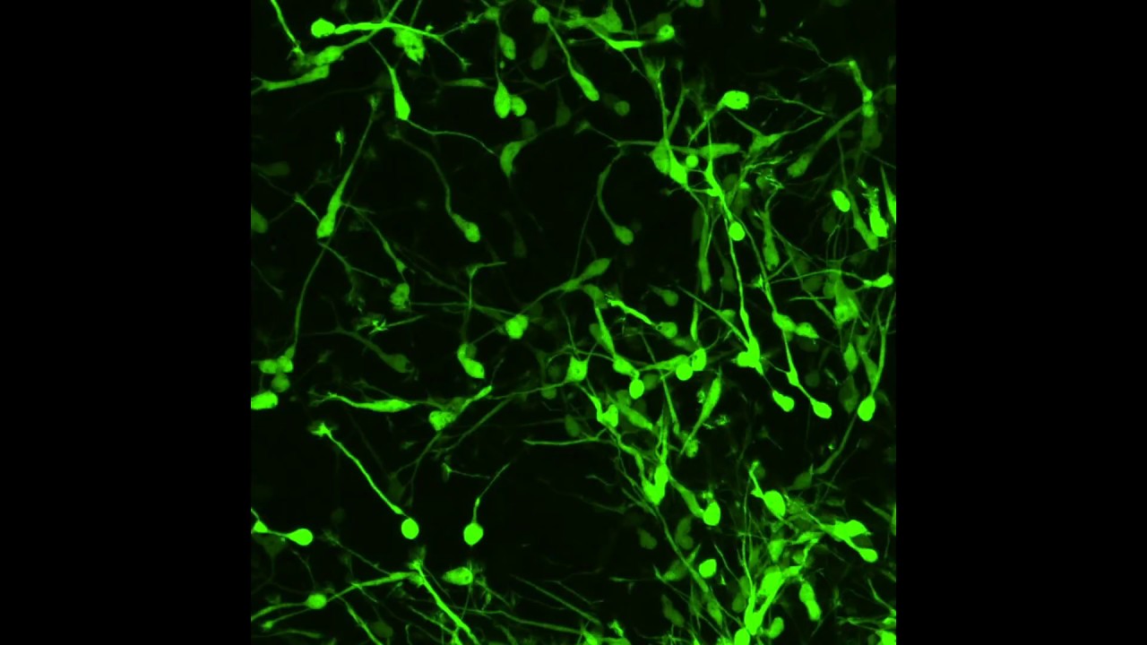 Controlling interneuron migration in the cortex