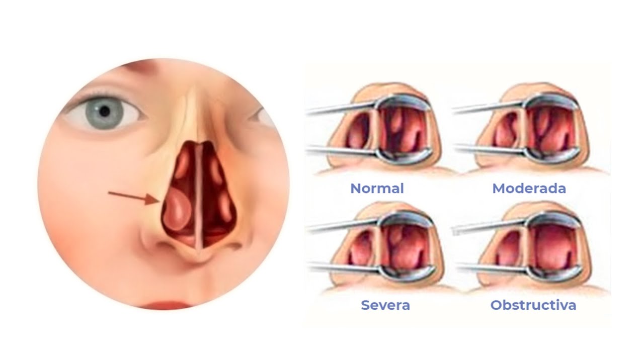 Juan Carlos Ramirez Rivera-47