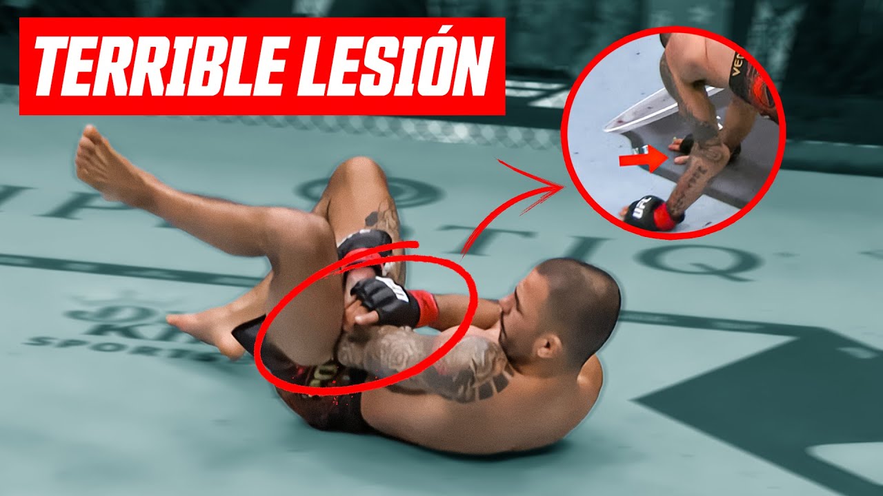 TERRIBLE LESIÓN de PANTOJA