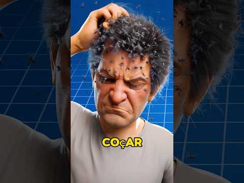 WHAT IF YOU CATCH LICE 😱#shorts