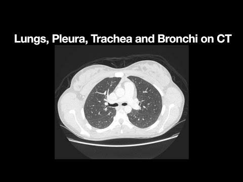 Anatomy of the Lung, Pleura, Trachea and Bronchi on CT