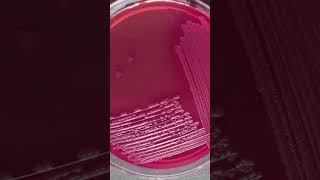 Download lagu Identification of E.coli #cled #medical mp3