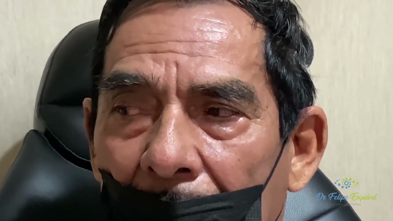 Caso de Éxito Sr. Ruben Ramirez Angulo. Dr.Felipe Esquivel