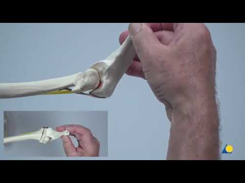 Pediatric Supracondylar Fracture Pinning