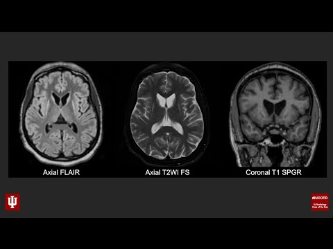 Brain Case of the Day 34