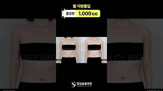 얇은 옷 핏 달라진 이유, 이 라인 때문임 ✨