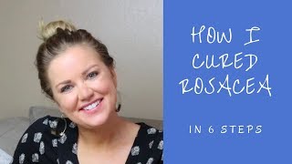 How I Cured Rosacea For Good! - 6 Steps