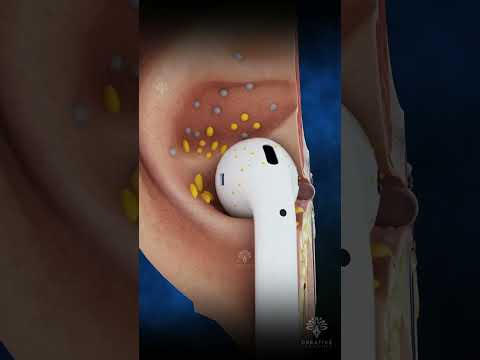 Why Your Earbuds Are Dirty #earinfection #earwax #shorts #viral -creativelearning3d