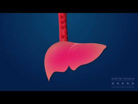 Love Your Liver - Customer Success Story