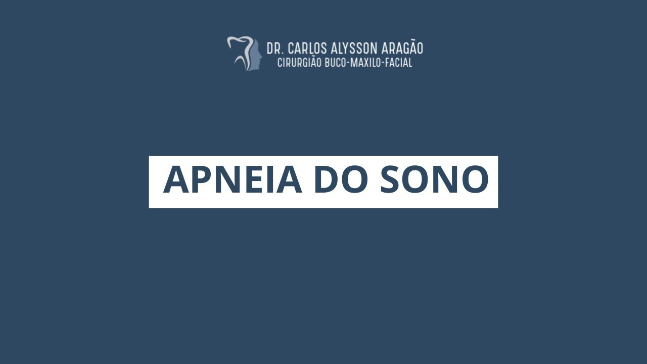 Carlos Alysson Aragão-65