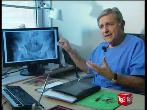 Cosa succederebbe se non trattata caviglia artrosica Se è possibile trattare osteocondrosi cervicale freddo