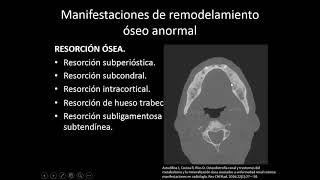 Caso del Mes n°47 Abril 2021, &quot;Osteodistrofia Renal&quot; Dra. Acacia Fernández