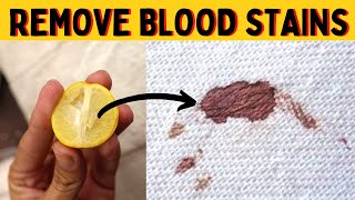How To Remove Old Dried Blood Stains From Mattress Without Washing It