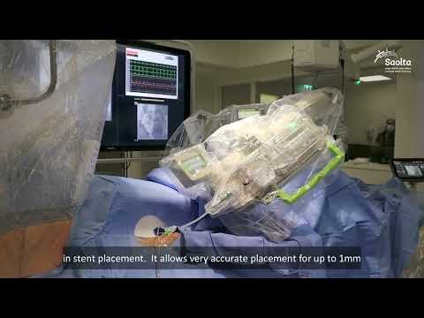 Amigo Remote Catheter System Video 2587