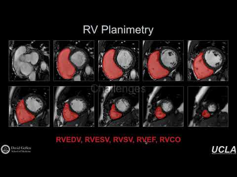 ISMRM MR Academy -Functional Analysis